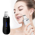 Rechargeable Facial Black Head Remover with Heating